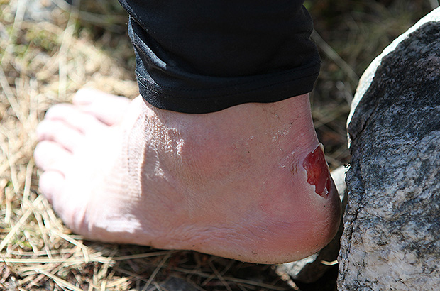 The consequences of hastily choosing climbing boots
