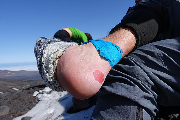 Последствия неудачного выбора размера ботинок для восхождения на Ключевскую сопку